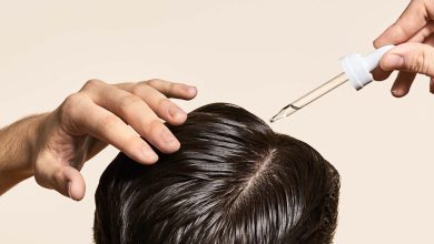minoxidil side effects- Minoxidil for Hair Loss in Female & its Side Effects