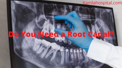 Root canal