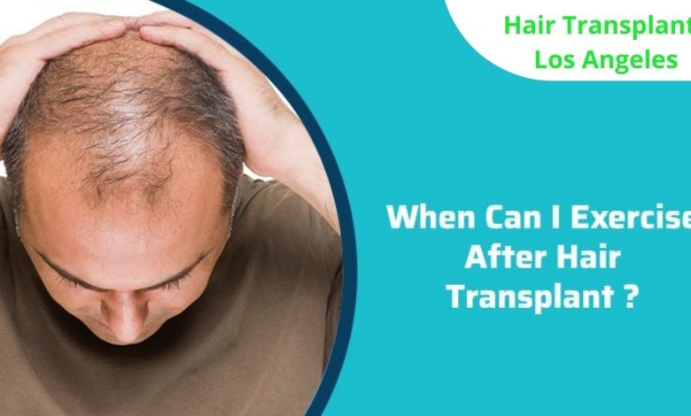when-can-i-exercise-after-hair-transplant