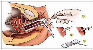 pap smear test