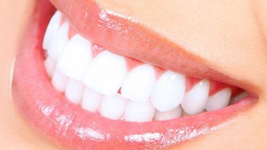 teeth whitening services