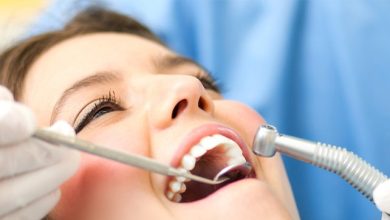 Wisdom Teeth Removal Services