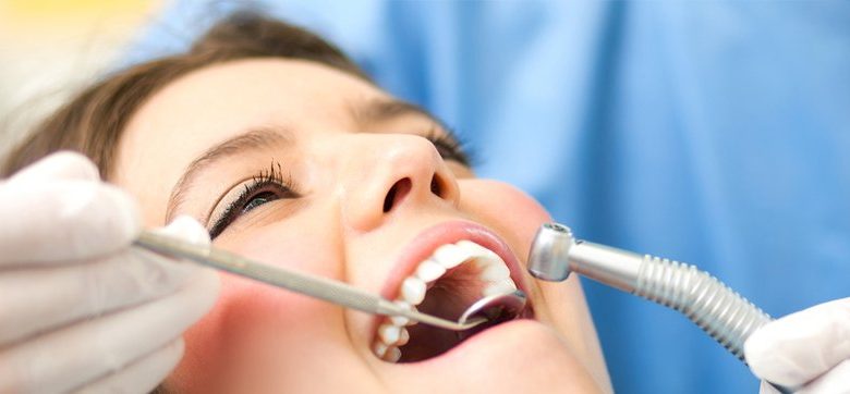 Wisdom Teeth Removal Services